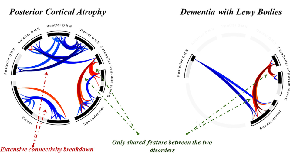 Altered structural & functional