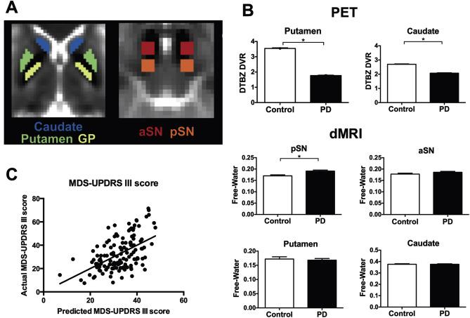 Multimodal dopaminergic and free-water imaging in Parkinson's disease