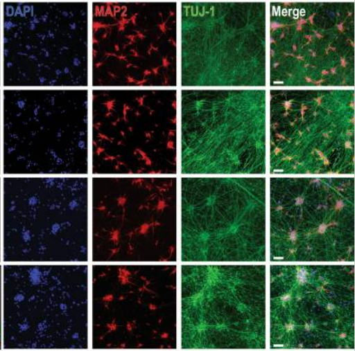 parkinson-causing mutations